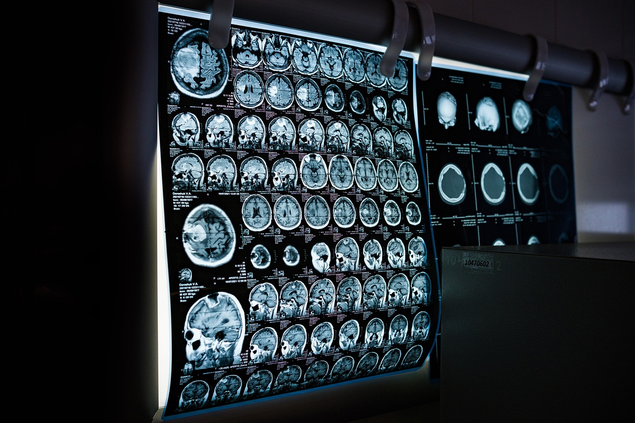 entdecken sie die neuesten innovationen und trends im bereich healthcare technology – von digitalen gesundheitslösungen bis zu modernen medizintechnologien. erfahren sie, wie technologie das gesundheitswesen revolutioniert und die patientenversorgung verbessert.